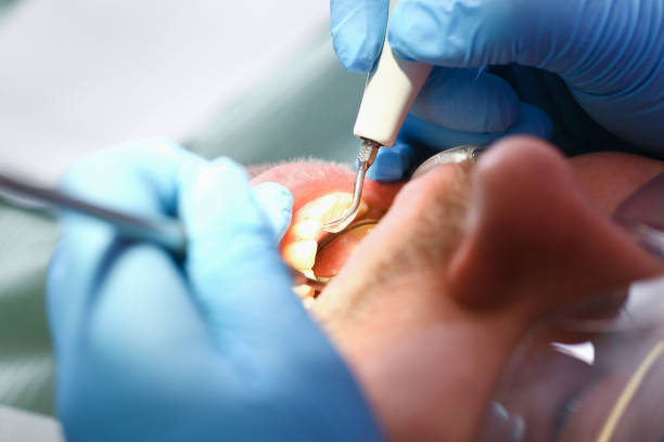 Best Walk-In Emergency Dentist in Calabash, NC